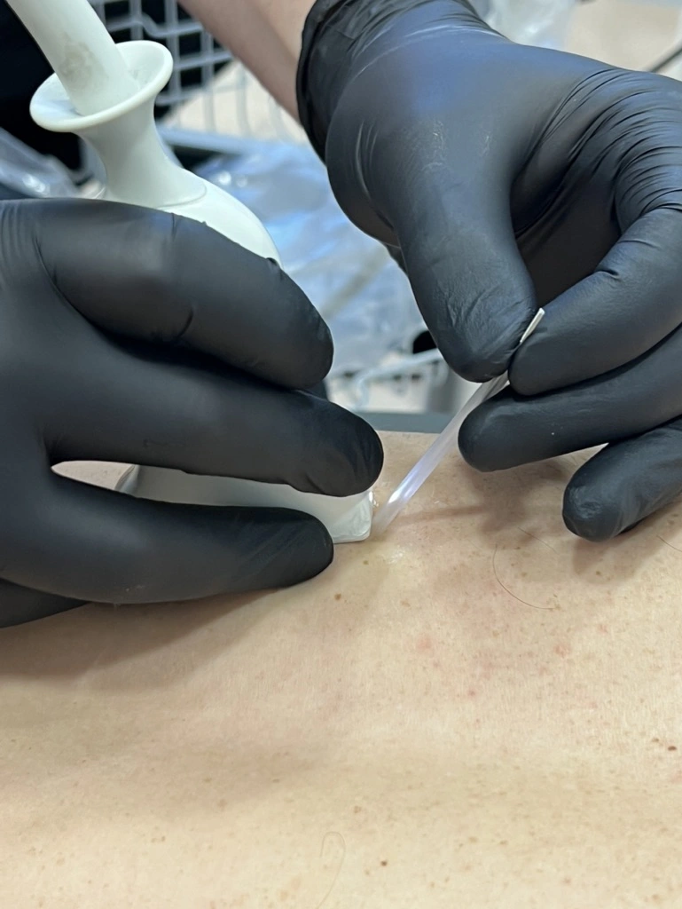 Fisioterapia invasiva ecoguiada